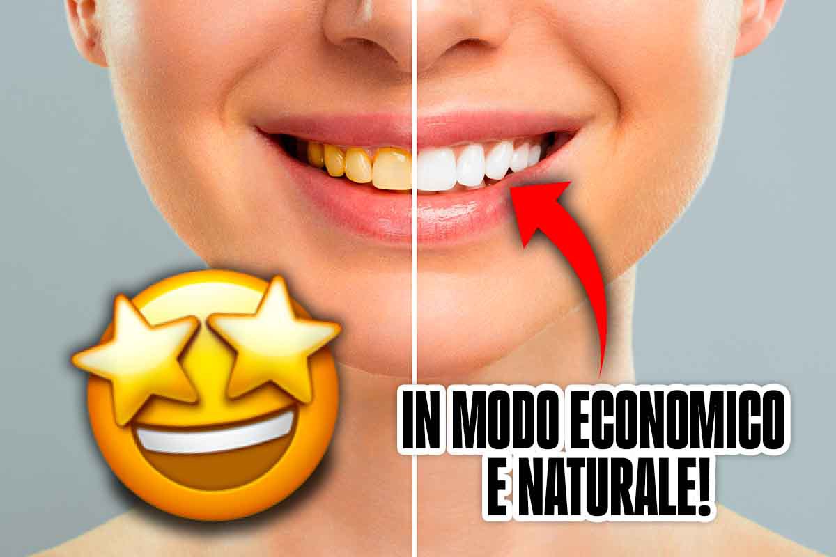 Sbiancamento denti, il metodo infallibile fai da te