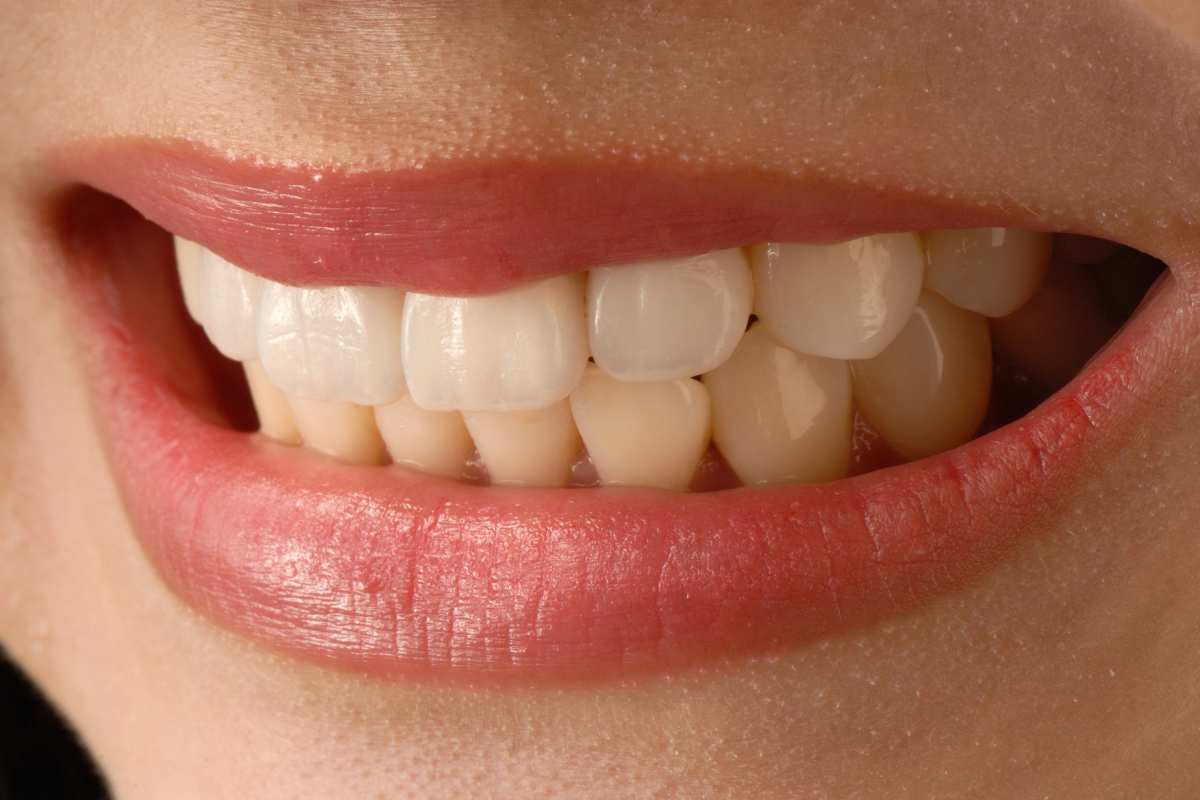 Consigli sulla salute dei denti