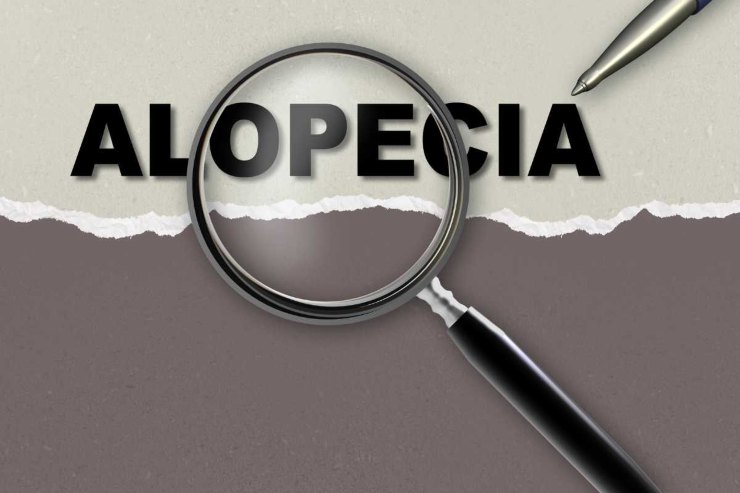 Alopecia, cause e sintomi