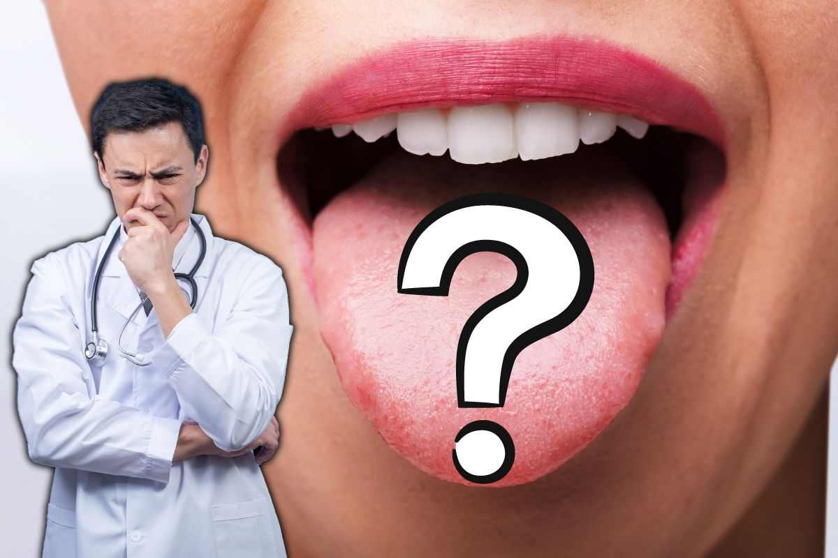 Osservare la lingua: i segnali di malattie da riconoscere