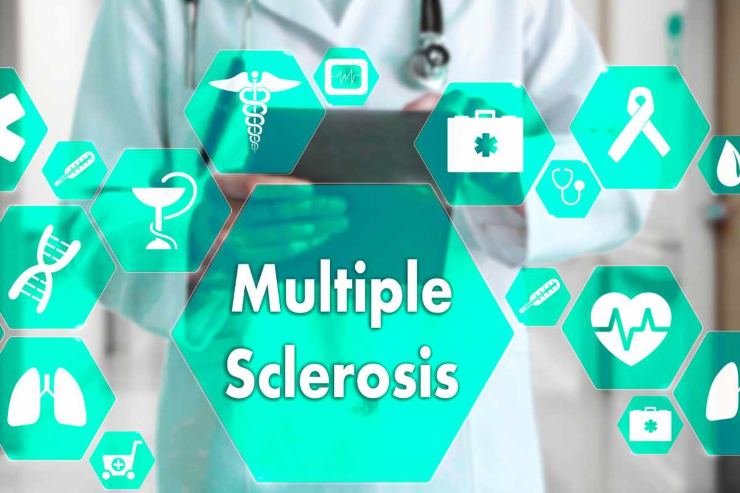 Sclerosi multipla: cause e sintomi