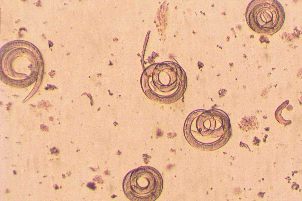 Trichinella: cosa sapere del parassita