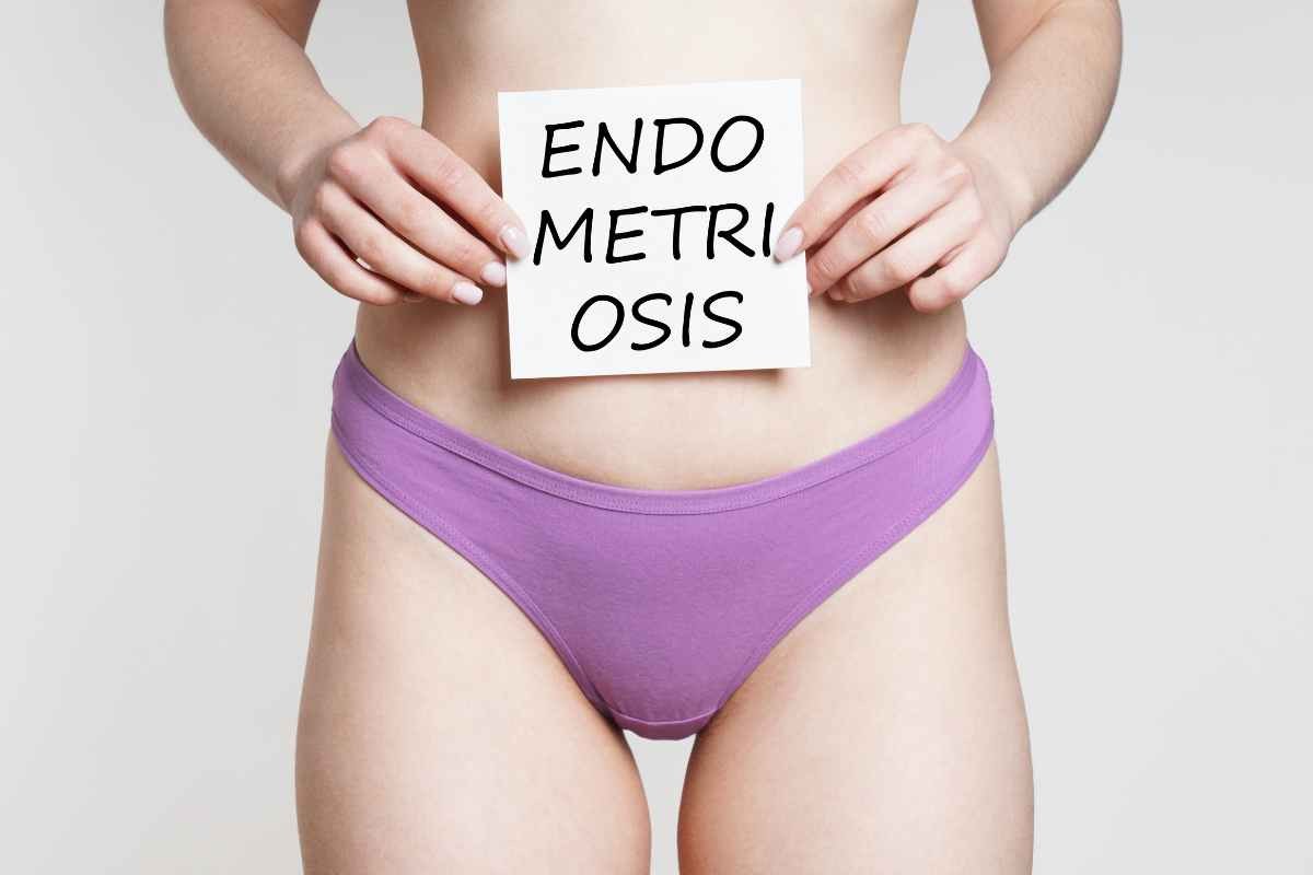 Endometriosi: i sintomi da non sottovalutare