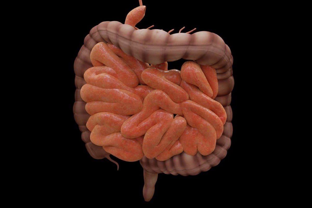 tumore intestino sintomi apparentemente innocui preoccupanti