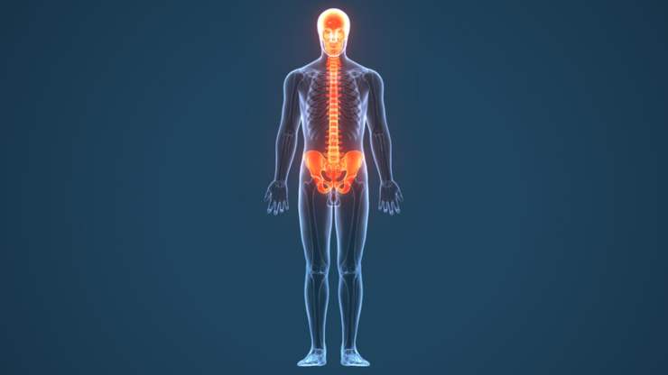 Grave patologia della colonna vertebrale