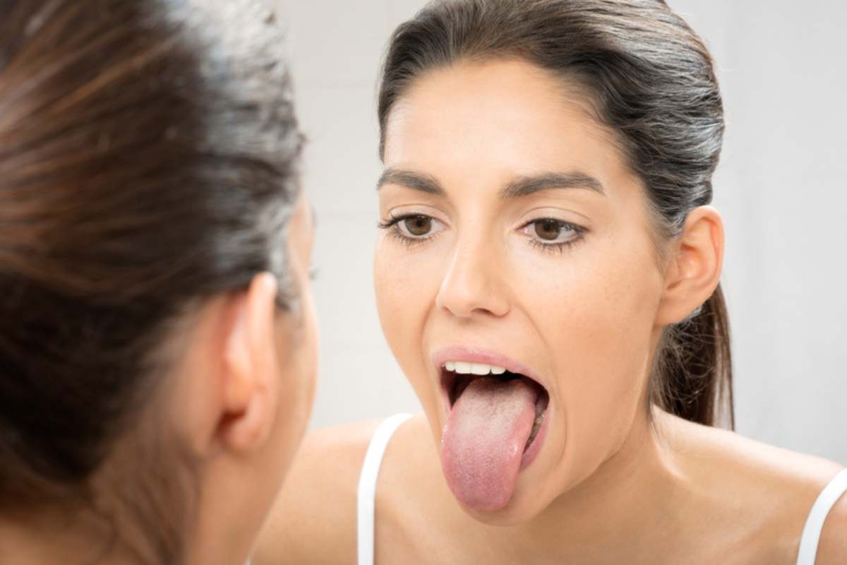 La lingua ti svela gravi patologie