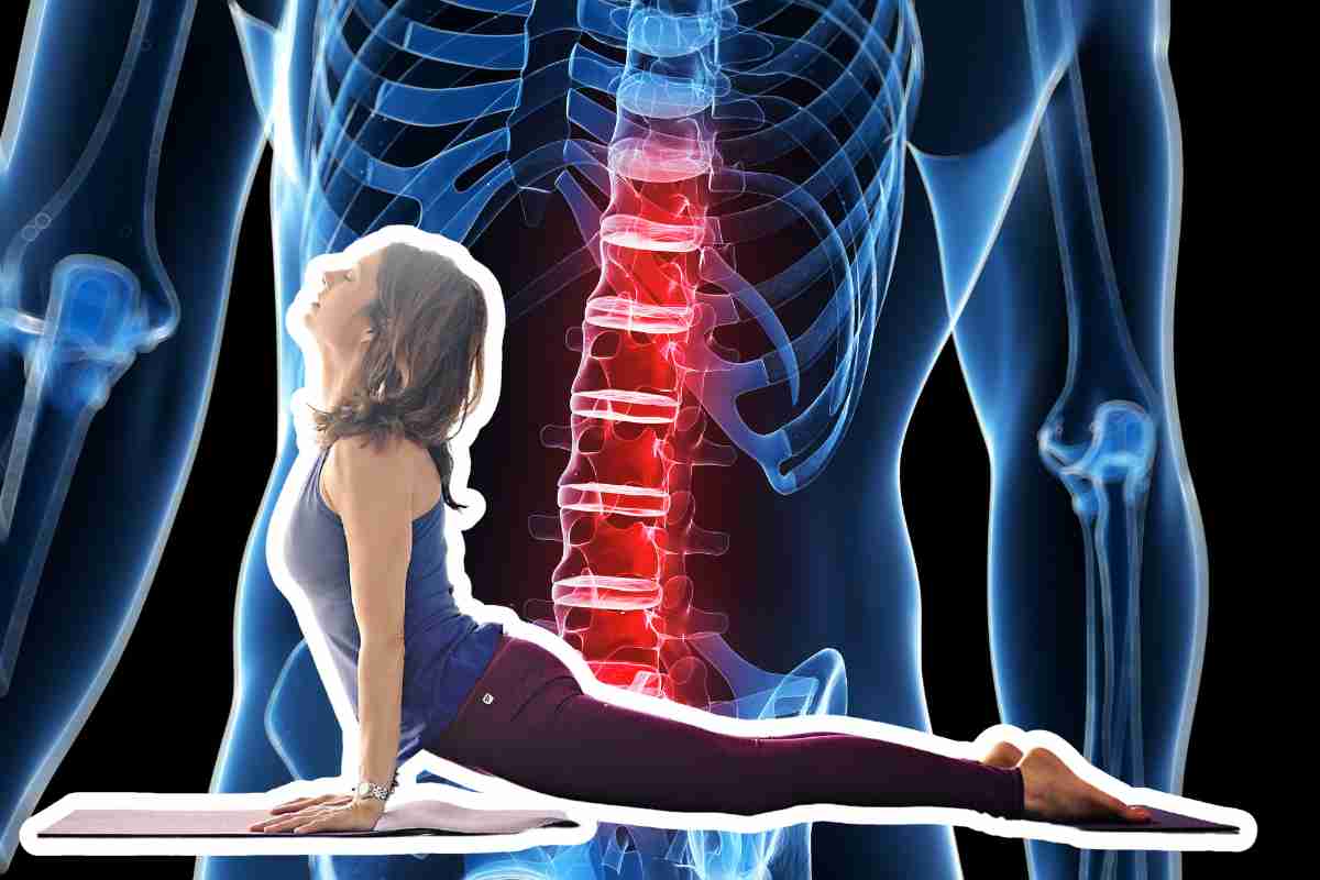 posizioni yoga mal di schiena 