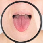9 malattie che puoi capire dalla lingua