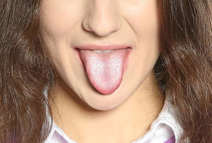 Controlla La Tua Lingua 9 Malattie Che Puoi Individuare Osservandola Controlla La Tua Lingua 9 Malattie Che Puoi Individuare Osservandola
