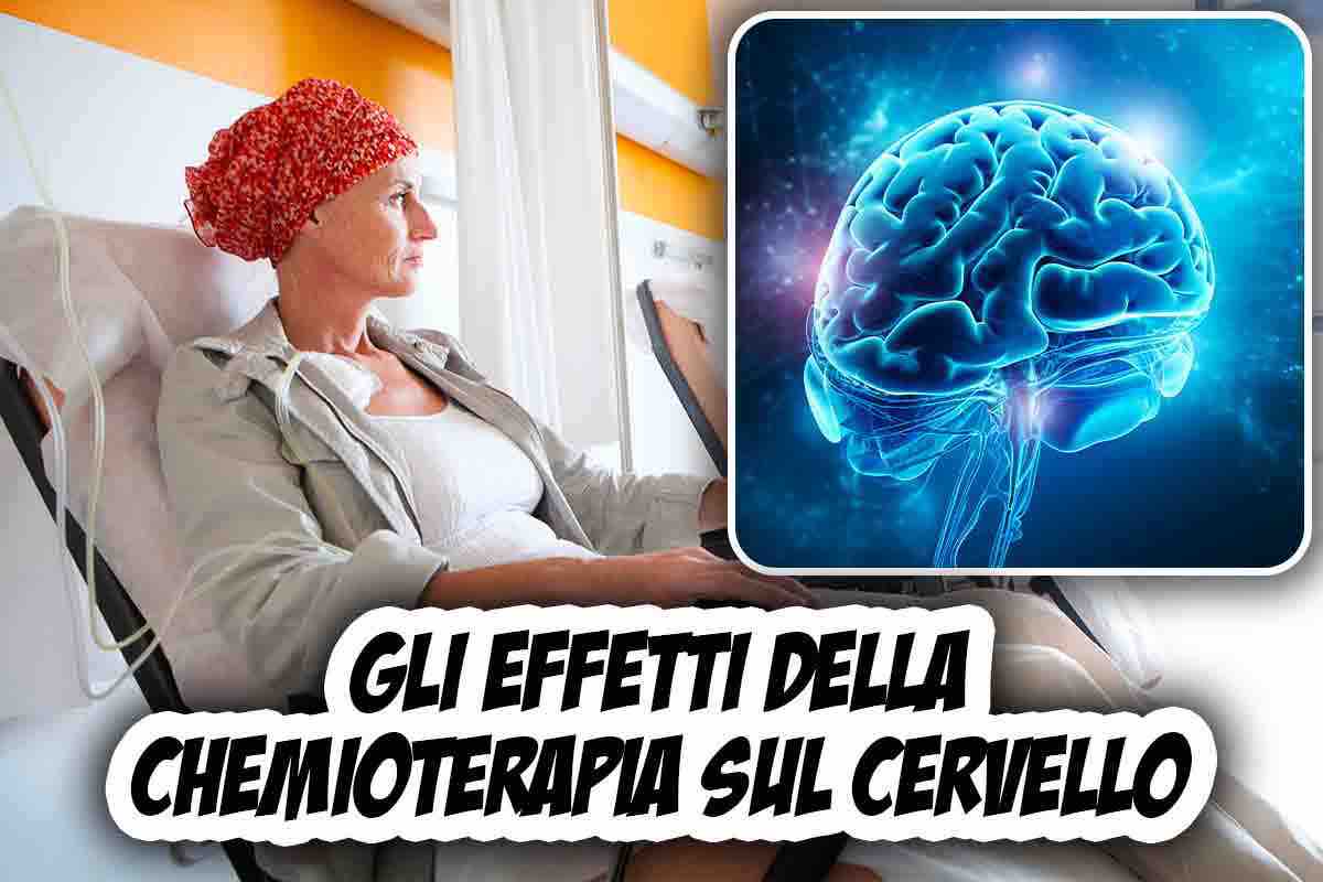 che cos'è il chemo brain