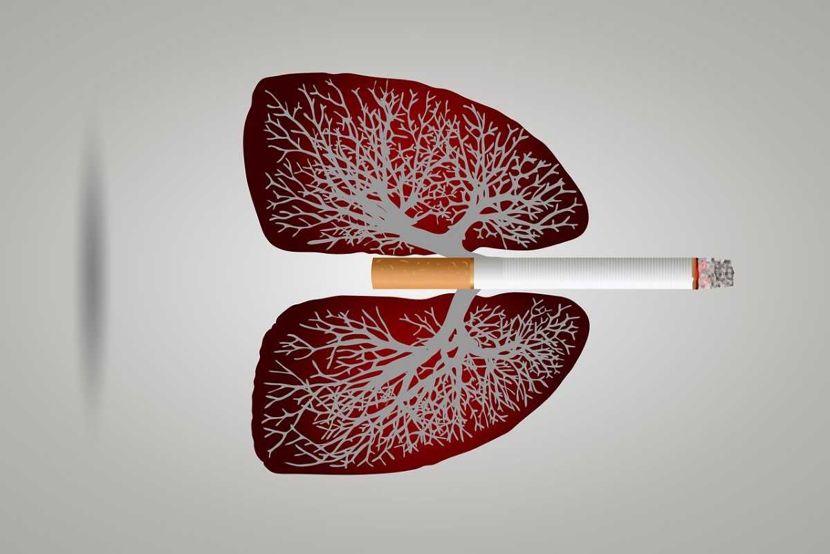 tumore polmoni sintomo più comune sottovalutato